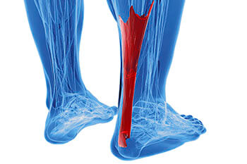 achilles tendon treatment in the Lehi, UT 84043 and Murray, UT 84123 area