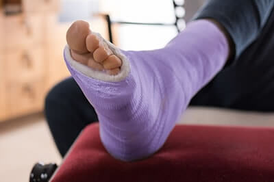 Broken Foot Treatment, Foot and ankle fractures treatment in the Lehi, UT 84043 and Murray, UT 84123 area